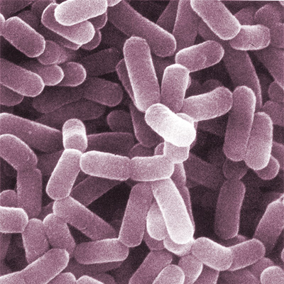 Lactobacillus casei; photo credit: CC BY-SA 2.0 by AJ Cann/flickr.com: http://bit.ly/1esNeSy