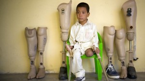 An Afghan child with only one leg sits next to artificial legs at the International Red Cross Orthopedic (ICRC) rehabilitation center on December 10, 2009 in Herat, Afghanistan © picture-alliance/landov